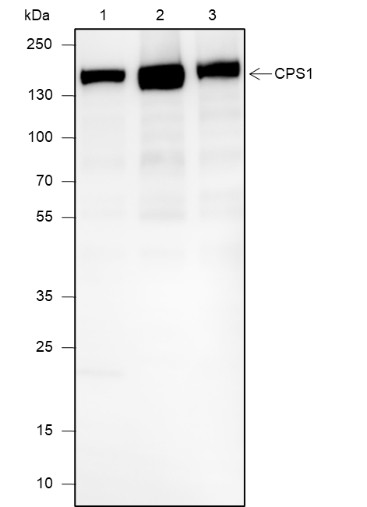 Recombinant CPS1 Monoclonal Antibody - 2