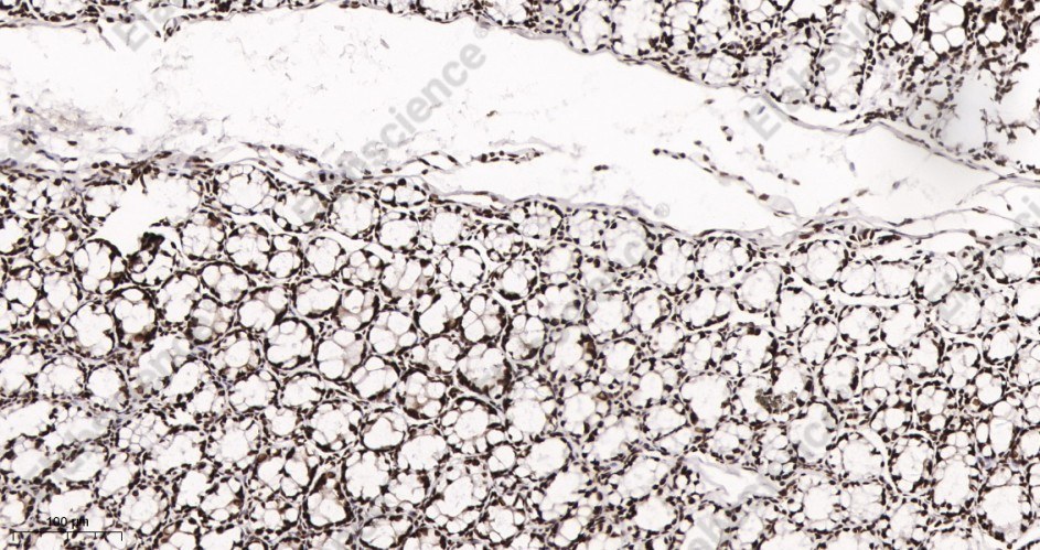 Recombinant HDAC2 Monoclonal Antibody - 2