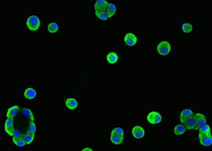 REG1A Monoclonal Antibody-searchlist-1