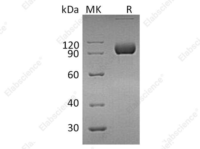 Recombinant Human EphA4 Protein (Fc Tag) - 1