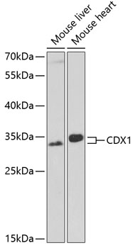 Western blot analysis of extracts of various cell lines using CDX1 Polyclonal Antibody at 1:1000 dilution.