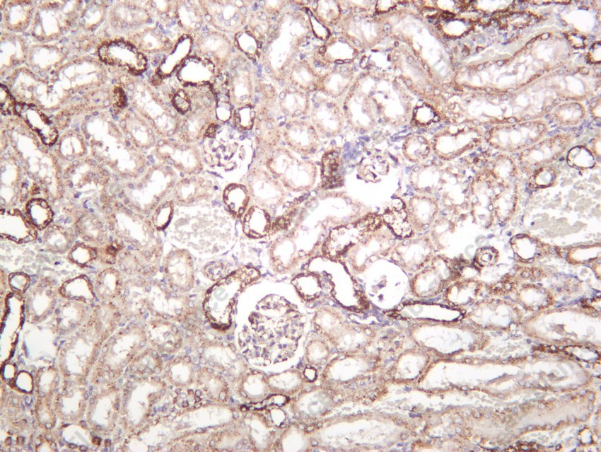 Recombinant SOD2 Monoclonal Antibody - 6