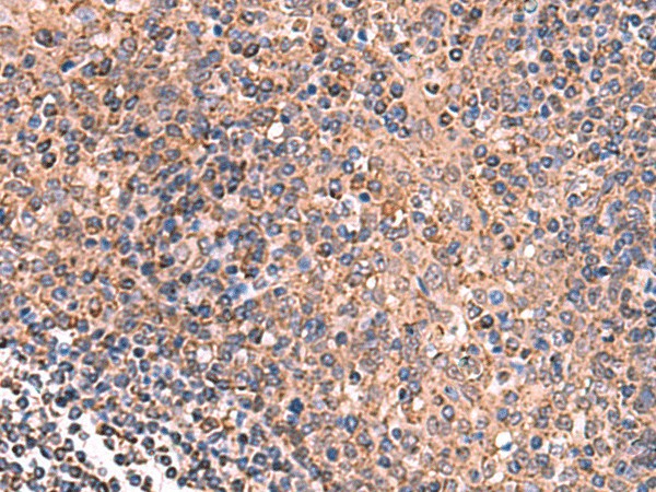 Immunohistochemistry of paraffin-embedded Human tonsil tissue  using GALK2 Polyclonal Antibody at dilution of 1:160(?200)