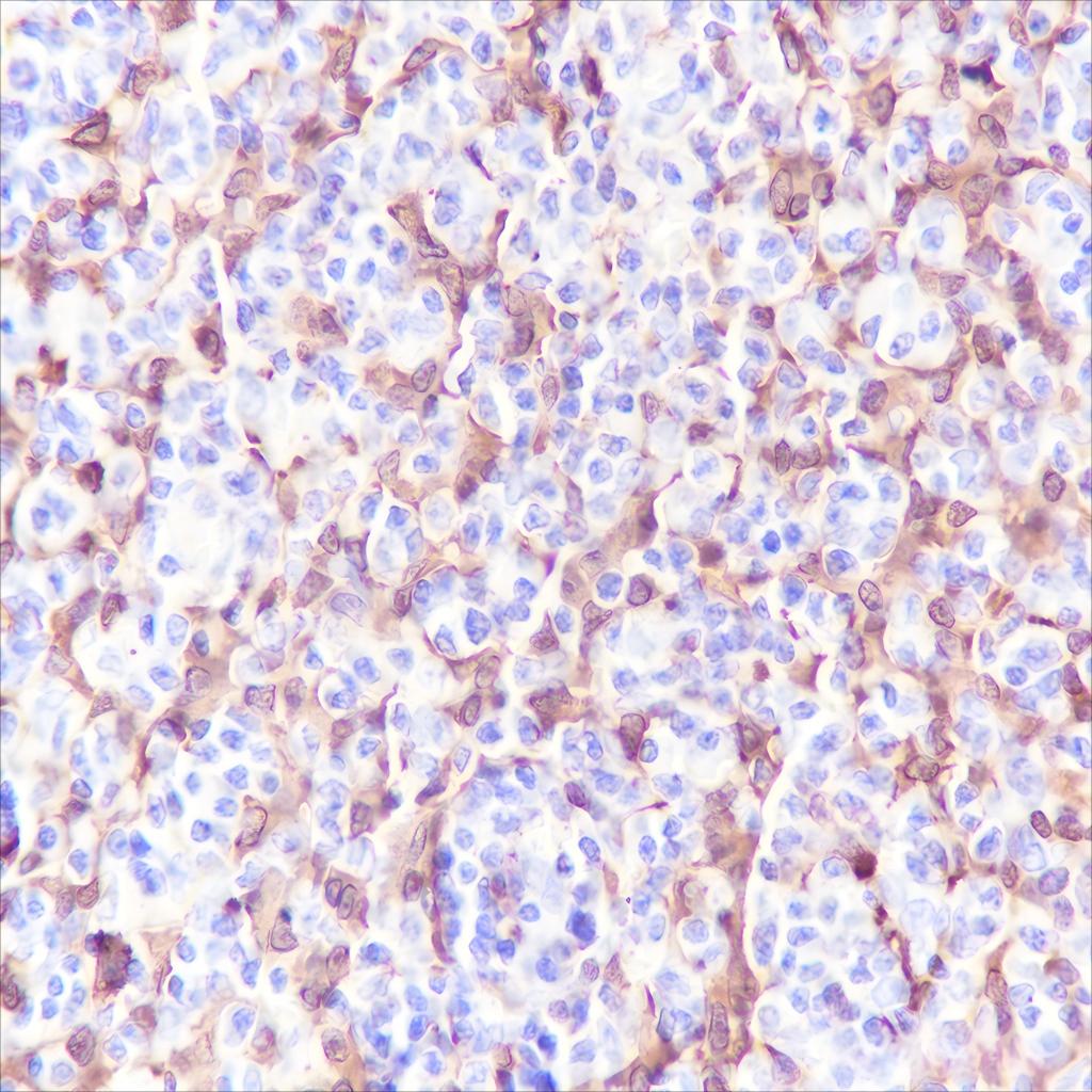 Recombinant S100A8 Monoclonal Antibody - small - 2
