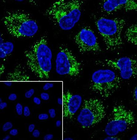 Recombinant GSTK1 Monoclonal Antibody - small - 3