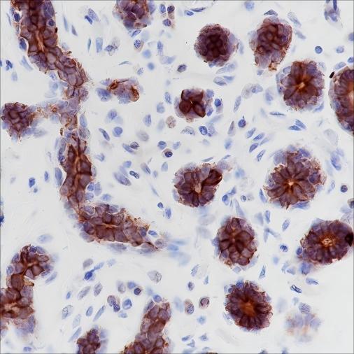 Recombinant Keratin 6 Monoclonal Antibody - small - 2