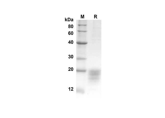 Recombinant Human PD1 Protein(His Tag)-产品推荐-1