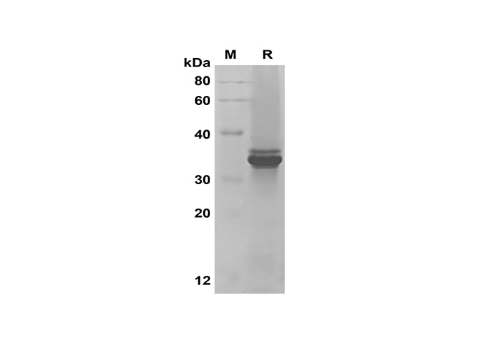 Recombinant Human IL-33 Protein-1
