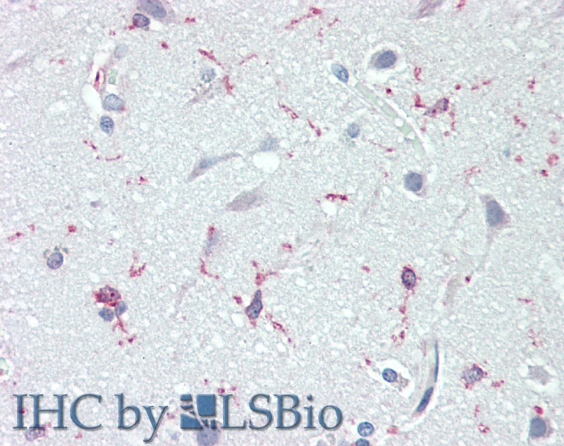 Immunohistochemistry of paraffin-embedded Human brain cortex  using NRN1 Polyclonal Antibody at dilution of 1:70(Elabscience Product Detected by Lifespan).