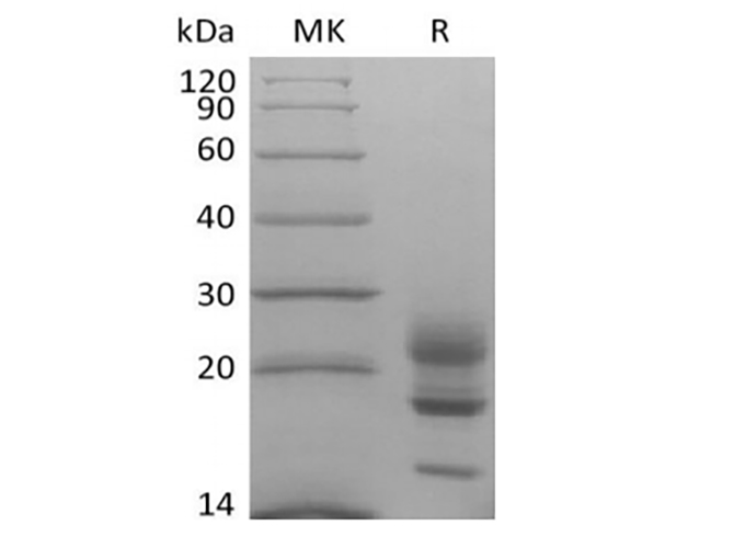 Immobilized Cynomolgus IL-17A-His (Cat#PKSQ050109) at 10 ug/ml (100 ul/well) can bind Anti-Human IL-17A mAb. The ED50 of Anti-Human IL-17A mAb is 128 ng/ml.