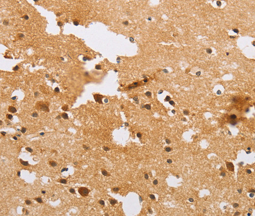 Immunohistochemistry of paraffin-embedded Human brain  tissue using ACTR2 Polyclonal Antibody at dilution 1:40