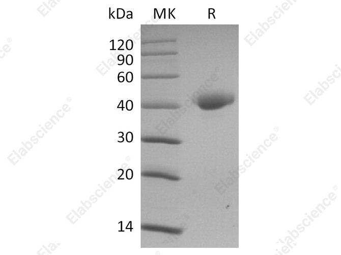 Recombinant SARS-CoV-2 Spike Protein, Biotinylated (RBD-SD1, Avi-His Tag) - 1