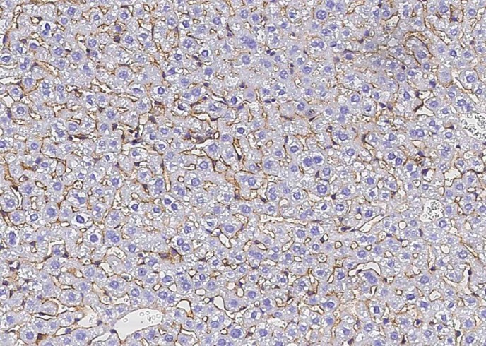 Recombinant SerpinF2/SERPINF2 Monoclonal Antibody-searchlist-1