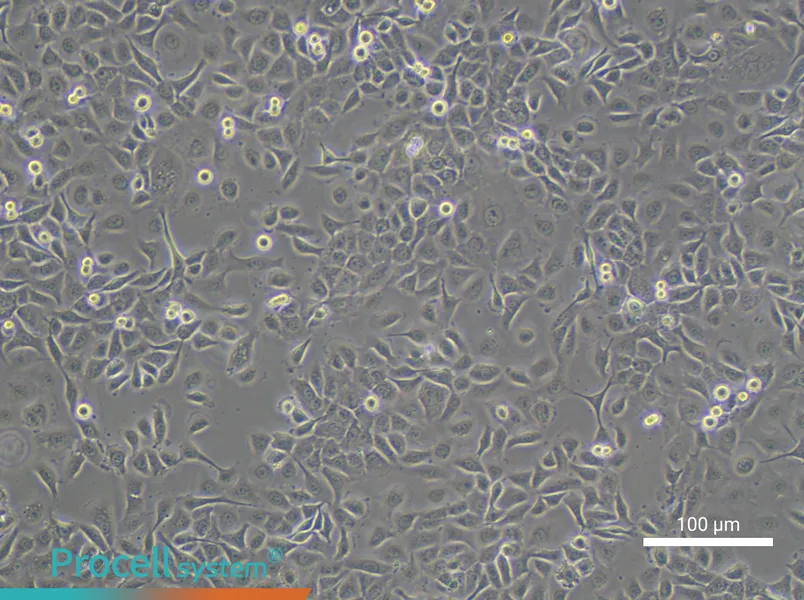 HCC 94 [HCC941122] - 1