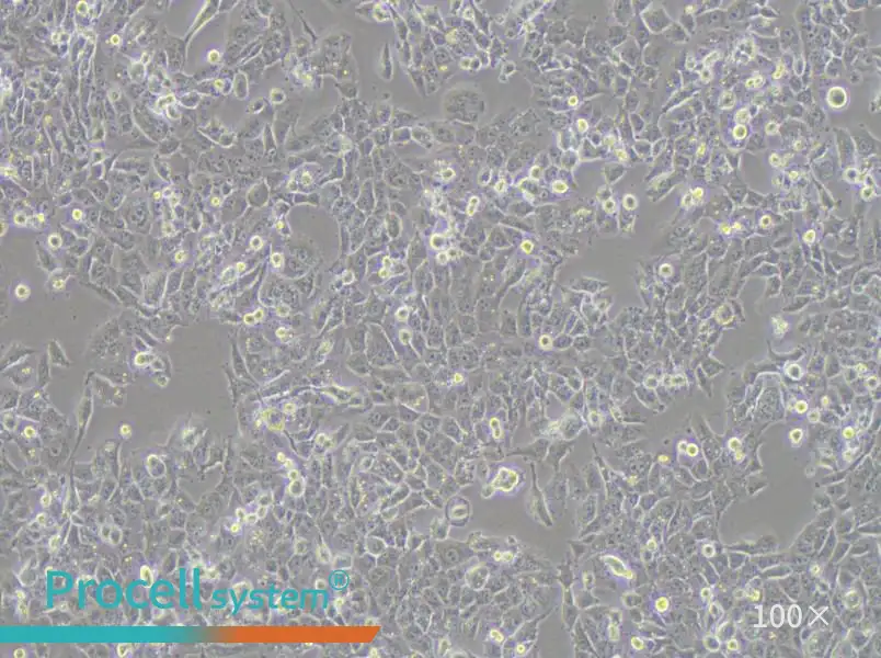 NCI-H1915 Cell Complete Medium - 1