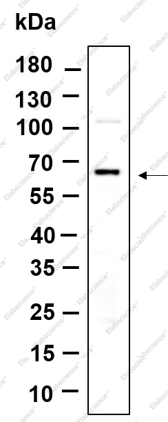 Recombinant PINK1 Monoclonal Antibody - 1