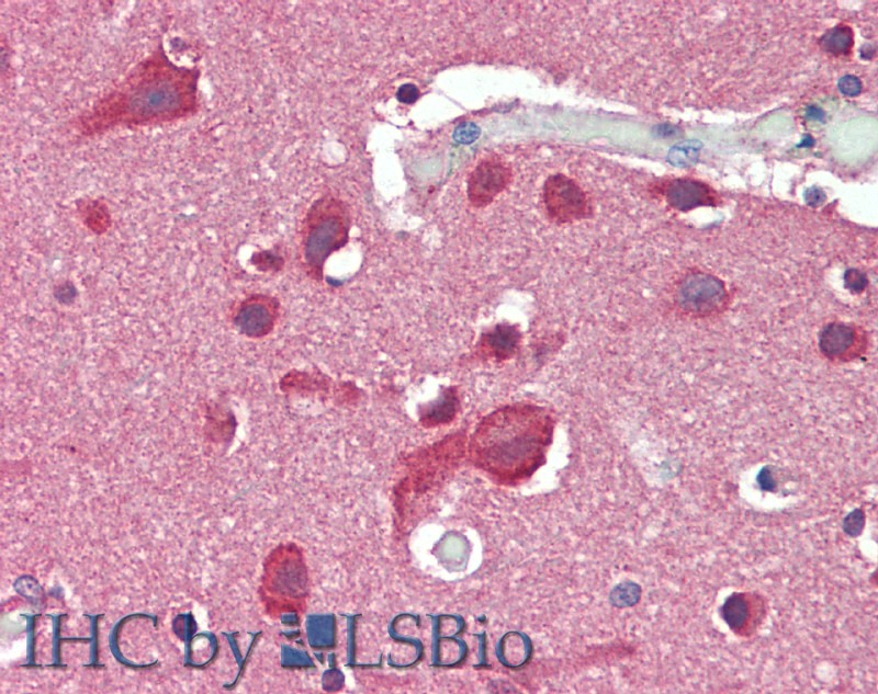 Immunohistochemistry of paraffin-embedded Brain, Cortex tissue using SLC8A3 Polyclonal Antibody at dilution of 1:50(Elabscience Product Detected by Lifespan).