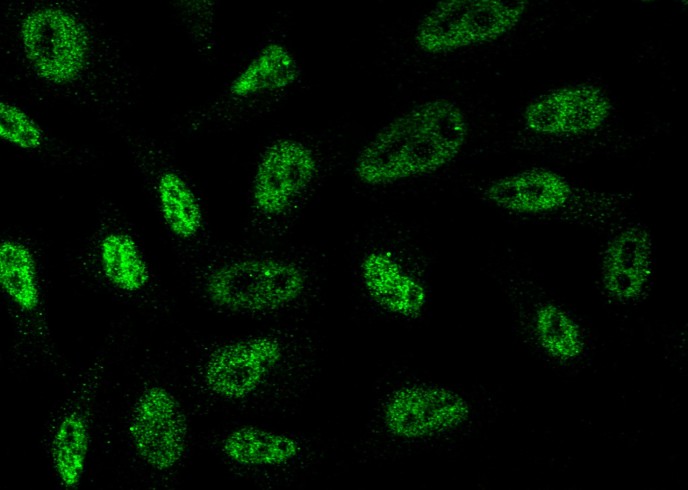 Brachyury/TBXT Monoclonal Antibody-searchlist-1