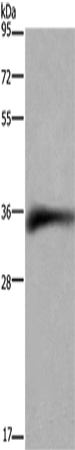 Western Blot analysis of Human placenta tissue using CD32 Polyclonal Antibody at dilution of 1:850