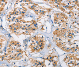 Cathepsin L Polyclonal Antibody - 3