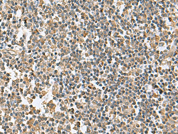 Immunohistochemistry of paraffin-embedded Human tonsil tissue  using KRCC1 Polyclonal Antibody at dilution of 1:95(?200)