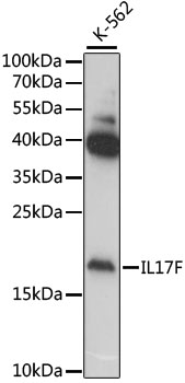 Western blot analysis of extracts of various cell lines using IL17F Polyclonal Antibody at 1:1000 dilution.