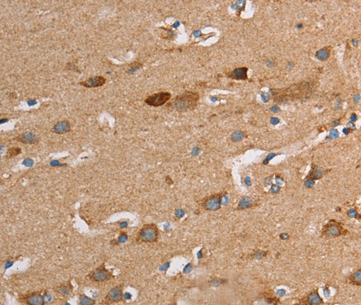 Immunohistochemistry of paraffin-embedded Human brain tissue using TLR8 Polyclonal Antibody at dilution 1:30