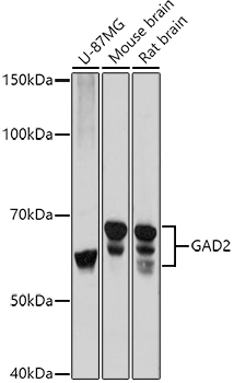 Western blot analysis of extracts of various cell lines using GAD65/GAD2 Polyclonal Antibody at 1:1000 dilution.