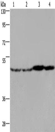 Western Blot analysis of Mouse liver, brain and heart tissue, RAW264.7 cell using FH Polyclonal Antibody at dilution of 1:850