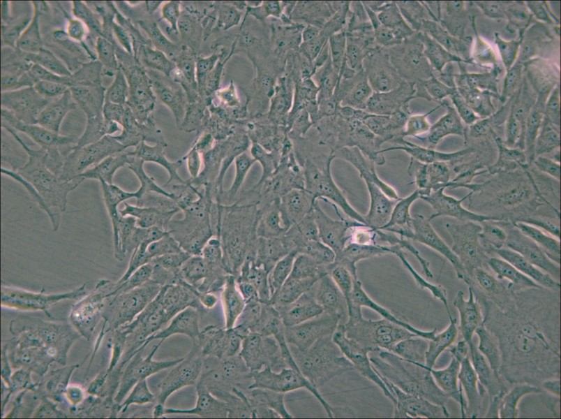 Calu-1 Cell Complete Medium - small - 6