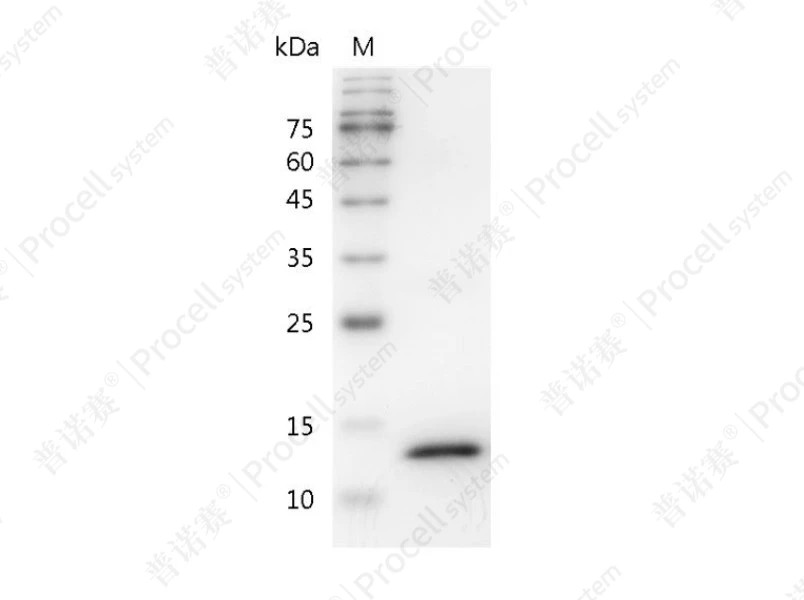 Interferon &gamma;/IFN-&gamma;/IFNG, Mouse, Recombinant