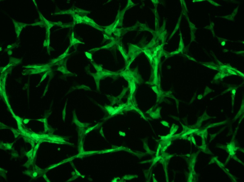 U-87 MG-GFP Cell Complete Medium - small - 8