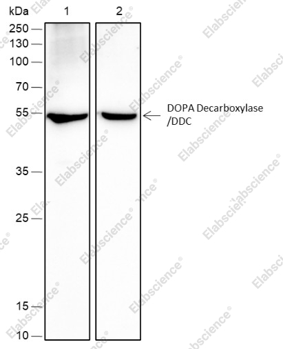 Recombinant DOPA Decarboxylase/DDC Monoclonal Antibody - 1