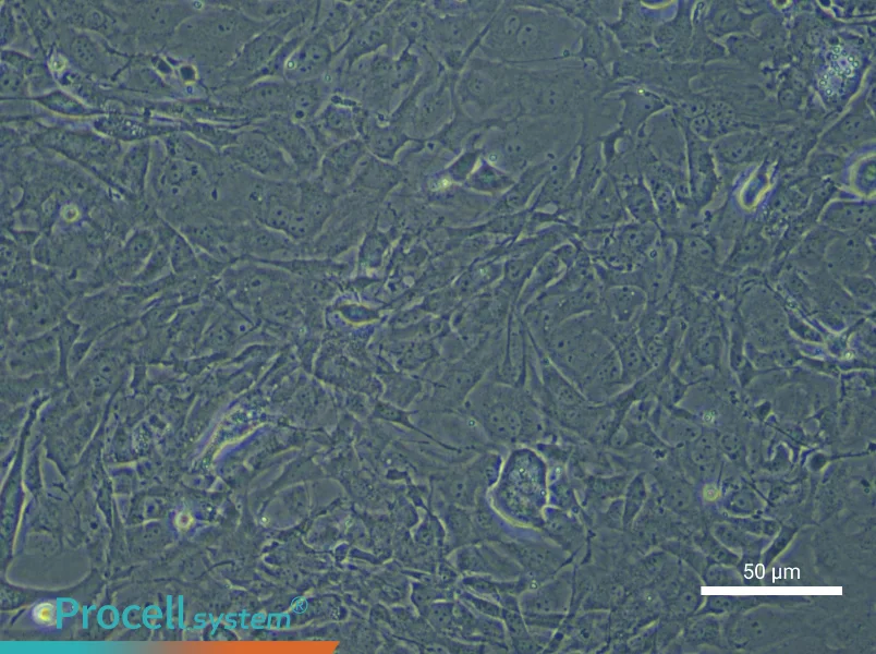 Mouse Trabecular Meshwork Cell Complete Medium - small - 6