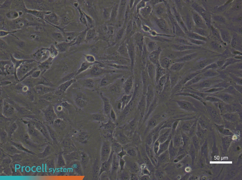 Human Lymphatic Endothelial (Primary cell immortalization) Cell Complete Medium - 4