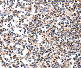 AFP Polyclonal Antibody - 3