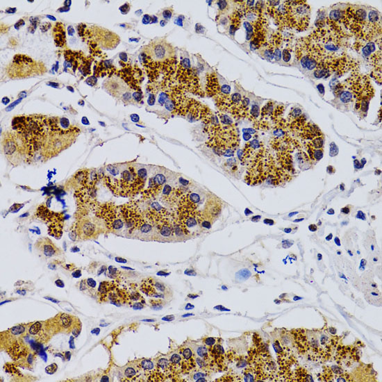 Immunohistochemistry of paraffin-embedded Human stomach using CDK7 Polyclonal Antibody at dilution of 1:200 (40x lens).