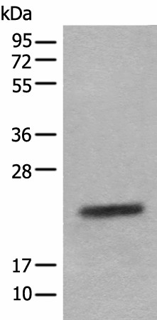 Western blot analysis of Mouse eye tissue lysate  using CRYGS Polyclonal Antibody at dilution of 1:800