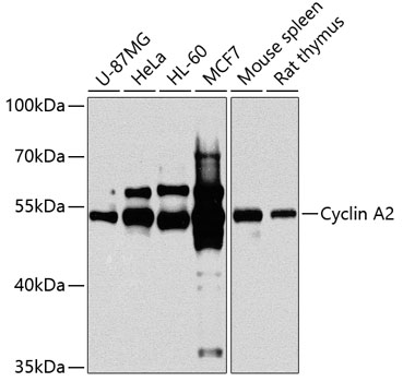 Western blot analysis of extracts of various cell lines using Cyclin A2 Polyclonal Antibody at 1:1000 dilution.