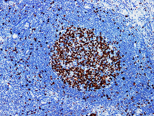 Immunohistochemistry of paraffinembedded Human tonsil tissue with Ki-67 Monoclonal Antibody(Antigen repaired by EDTA).