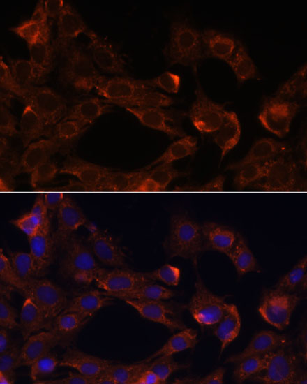 Immunofluorescence analysis of C6 cells using NRP1 Polyclonal Antibody at dilution of  1:100. Blue: DAPI for nuclear staining.