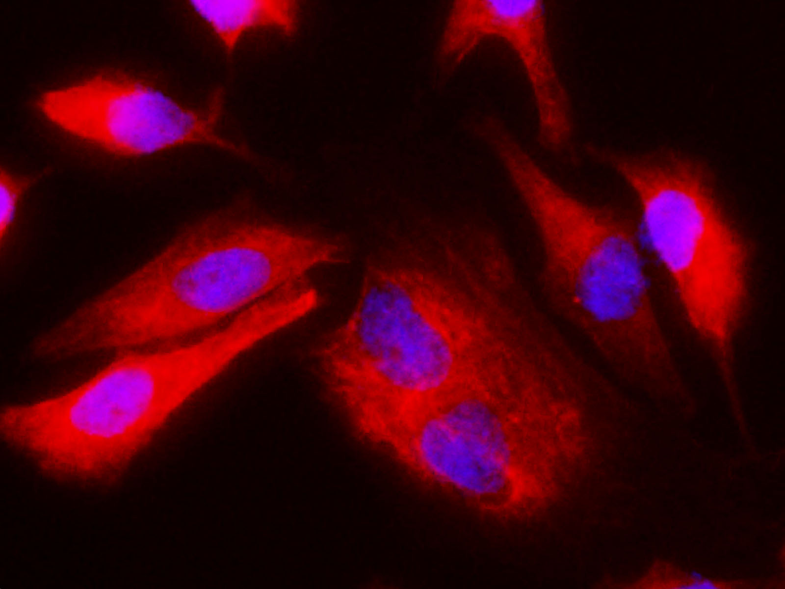 Purified Anti-Human CD54 Antibody[BI-AB]-产品推荐-1