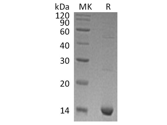 Recombinant Human S100A9 Protein