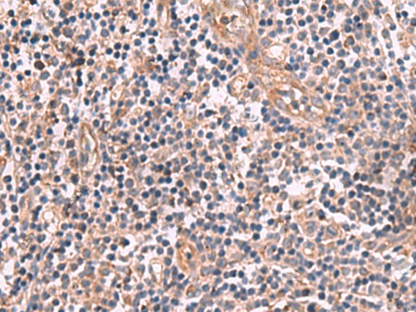 Immunohistochemistry of paraffin-embedded Human tonsil tissue  using MGP Polyclonal Antibody at dilution of 1:75(?200)