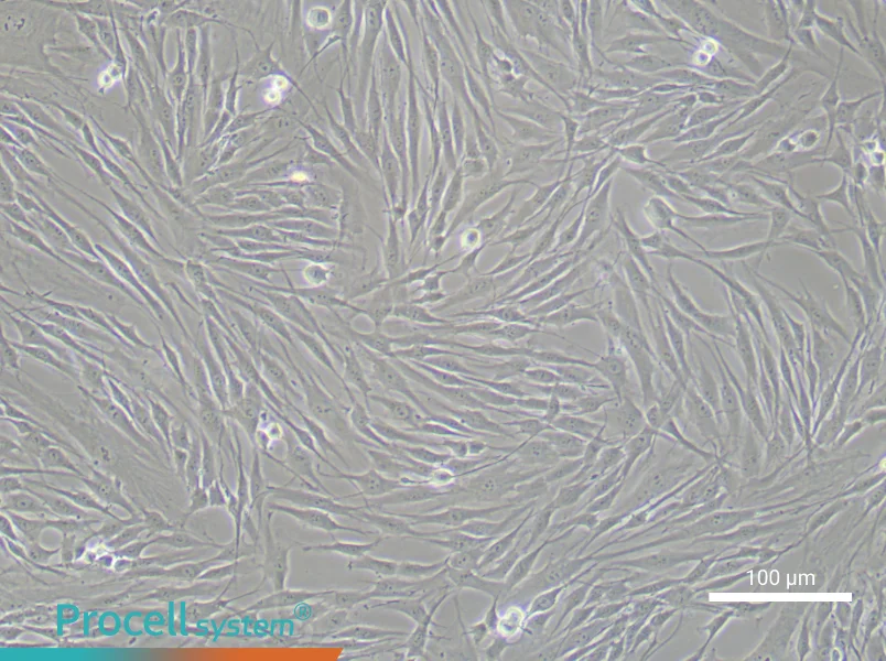 Human Coronary Artery Smooth Muscle Cell Complete Medium - 1