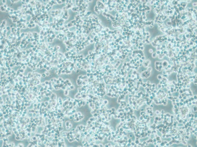 alpha TC1 clone 6 Cell Complete Medium-searchlist-1