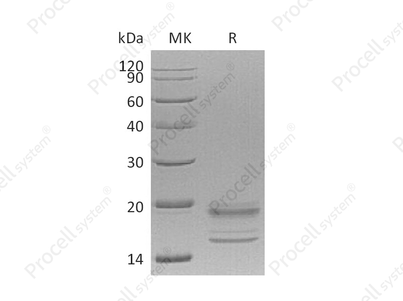 IL-17A/F (C-6His), Human, Recombinant