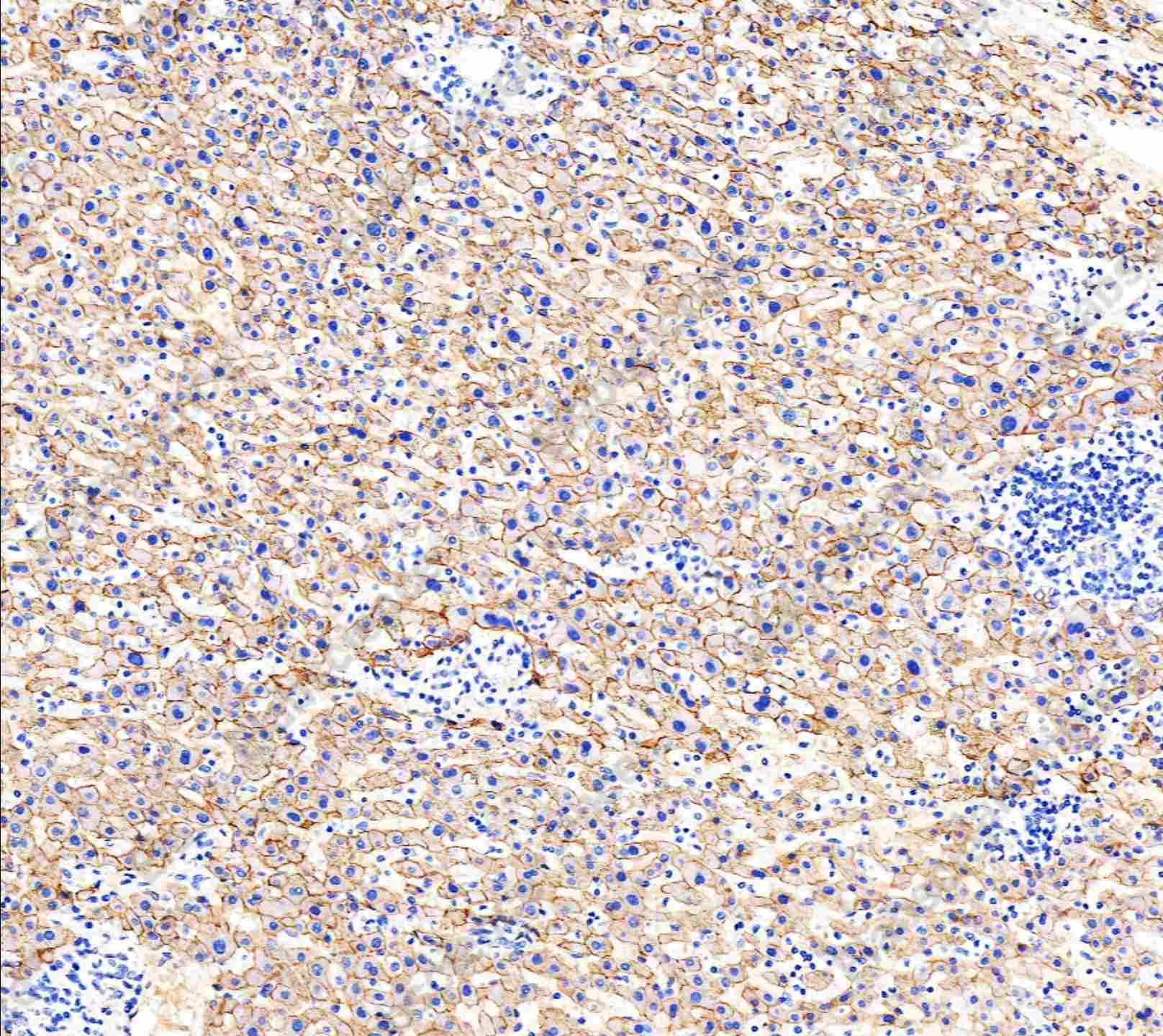 Recombinant E-Cadherin/CDH1/E-cad/CD324 Monoclonal Antibody - 2