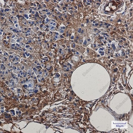 Recombinant Creatine kinase B type Monoclonal Antibody - 2