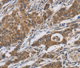RAGE Polyclonal Antibody - 3